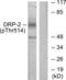 Dihydropyrimidinase Like 2 antibody, LS-C198892, Lifespan Biosciences, Western Blot image 