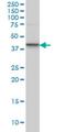 Serum/Glucocorticoid Regulated Kinase 2 antibody, H00010110-M09, Novus Biologicals, Western Blot image 