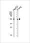 Aldehyde Dehydrogenase 1 Family Member A1 antibody, 57-893, ProSci, Western Blot image 