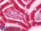 Galectin 3 antibody, LS-B11594, Lifespan Biosciences, Immunohistochemistry frozen image 