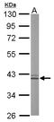 Arginase 1 antibody, LS-C186055, Lifespan Biosciences, Western Blot image 