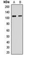 Serpin Family F Member 1 antibody, orb412382, Biorbyt, Western Blot image 