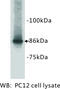 Chromogranin A antibody, MBS355062, MyBioSource, Western Blot image 