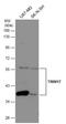 Tripartite Motif Containing 17 antibody, GTX116138, GeneTex, Western Blot image 