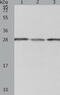 Proteasome 26S Subunit, Non-ATPase 9 antibody, TA324245, Origene, Western Blot image 