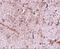 Translocase Of Outer Mitochondrial Membrane 70 antibody, GTX85358, GeneTex, Immunohistochemistry paraffin image 