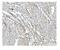 ADP Ribosylation Factor 6 antibody, PB9987, Boster Biological Technology, Immunohistochemistry paraffin image 
