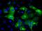 Interferon Induced Protein With Tetratricopeptide Repeats 3 antibody, NBP2-02148, Novus Biologicals, Immunocytochemistry image 