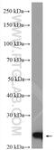 Protein Phosphatase 1 Regulatory Inhibitor Subunit 14B antibody, 18476-1-AP, Proteintech Group, Western Blot image 