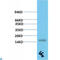 Transthyretin antibody, LS-C813252, Lifespan Biosciences, Western Blot image 