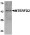 Mitochondrial Transcription Termination Factor 4 antibody, TA320100, Origene, Western Blot image 