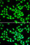 Protein-L-Isoaspartate (D-Aspartate) O-Methyltransferase antibody, STJ28767, St John