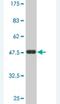 Adhesion G Protein-Coupled Receptor L1 antibody, H00022859-M03, Novus Biologicals, Western Blot image 