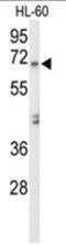 Amylase Alpha 1C (Salivary) antibody, AP50166PU-N, Origene, Western Blot image 