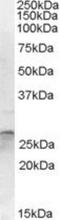 OTU Deubiquitinase, Ubiquitin Aldehyde Binding 2 antibody, NBP1-20958, Novus Biologicals, Western Blot image 