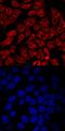 Interferon Regulatory Factor 2 Binding Protein 1 antibody, PA5-47877, Invitrogen Antibodies, Immunocytochemistry image 