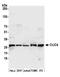 Chloride Intracellular Channel 4 antibody, A305-372A, Bethyl Labs, Western Blot image 