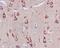 RAB5A, Member RAS Oncogene Family antibody, ab109534, Abcam, Immunohistochemistry paraffin image 