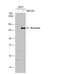 Brevican antibody, NBP2-15616, Novus Biologicals, Western Blot image 