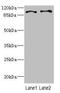 Centriolar Coiled-Coil Protein 110 antibody, LS-C675474, Lifespan Biosciences, Western Blot image 