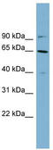 Keratin 84 antibody, TA333593, Origene, Western Blot image 