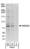 WD Repeat Domain 26 antibody, A302-244A, Bethyl Labs, Western Blot image 