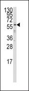 Interferon Regulatory Factor 5 antibody, PA5-12437, Invitrogen Antibodies, Western Blot image 