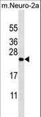 Zinc Finger CCHC-Type And RNA Binding Motif Containing 1 antibody, LS-C160749, Lifespan Biosciences, Western Blot image 