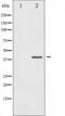 Histone Deacetylase 8 antibody, TA325524, Origene, Western Blot image 