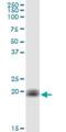 Cytochrome B5 Type B antibody, H00080777-B01P, Novus Biologicals, Western Blot image 