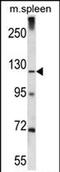 KIAA1324 antibody, PA5-71726, Invitrogen Antibodies, Western Blot image 