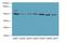 Zinc Finger Protein 398 antibody, LS-C394941, Lifespan Biosciences, Western Blot image 