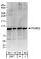 Proteasome 26S Subunit, Non-ATPase 2 antibody, A303-853A, Bethyl Labs, Western Blot image 