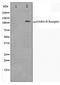 Gamma-Aminobutyric Acid Type B Receptor Subunit 1 antibody, TA347383, Origene, Western Blot image 