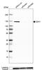 Cadherin 1 antibody, AMAb90863, Atlas Antibodies, Western Blot image 