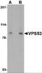 VPS53 Subunit Of GARP Complex antibody, 4593, ProSci, Western Blot image 