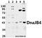 DnaJ Heat Shock Protein Family (Hsp40) Member B4 antibody, A06835, Boster Biological Technology, Western Blot image 