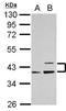 Apolipoprotein L1 antibody, GTX106472, GeneTex, Western Blot image 