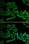 Thiopurine S-Methyltransferase antibody, LS-C331205, Lifespan Biosciences, Immunofluorescence image 