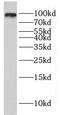 E74 Like ETS Transcription Factor 1 antibody, FNab02735, FineTest, Western Blot image 