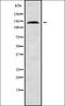 Unc-51 Like Kinase 4 antibody, orb338687, Biorbyt, Western Blot image 