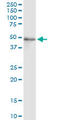 Fatty Acid Desaturase 3 antibody, LS-C197619, Lifespan Biosciences, Western Blot image 