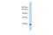 Myosin Binding Protein C, Cardiac antibody, A01078, Boster Biological Technology, Western Blot image 