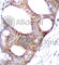 Glycogen Synthase Kinase 3 Alpha antibody, AP0120, ABclonal Technology, Immunohistochemistry paraffin image 