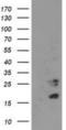 Cyclin Dependent Kinase Inhibitor 3 antibody, NBP2-01245, Novus Biologicals, Western Blot image 