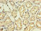 Interferon Alpha 10 antibody, LS-C317964, Lifespan Biosciences, Immunohistochemistry paraffin image 