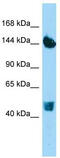 Collagen Type XXII Alpha 1 Chain antibody, TA331619, Origene, Western Blot image 