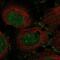 Mitogen-Activated Protein Kinase Kinase Kinase 12 antibody, NBP2-58000, Novus Biologicals, Immunofluorescence image 