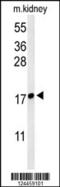 LY6/PLAUR Domain Containing 1 antibody, 64-091, ProSci, Western Blot image 