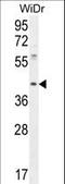 tRNA-dihydrouridine synthase 4-like antibody, LS-C167565, Lifespan Biosciences, Western Blot image 